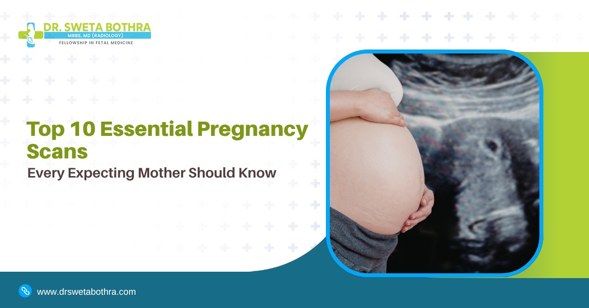 Top 10 Essential Pregnancy Scans Every Expecting Mother Should Know