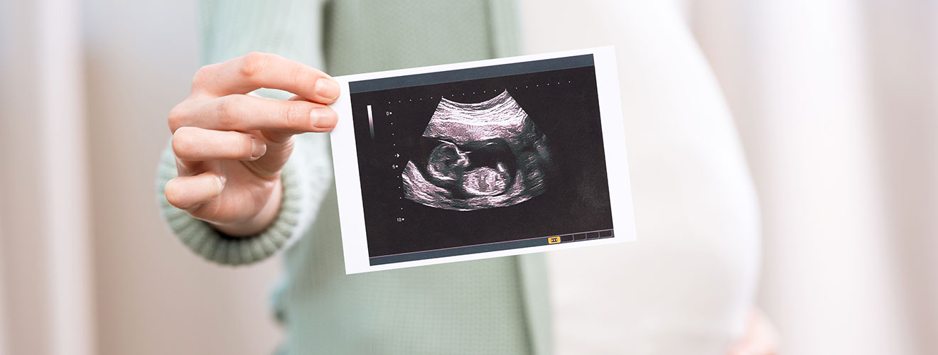 Fetal Anatomy Scan