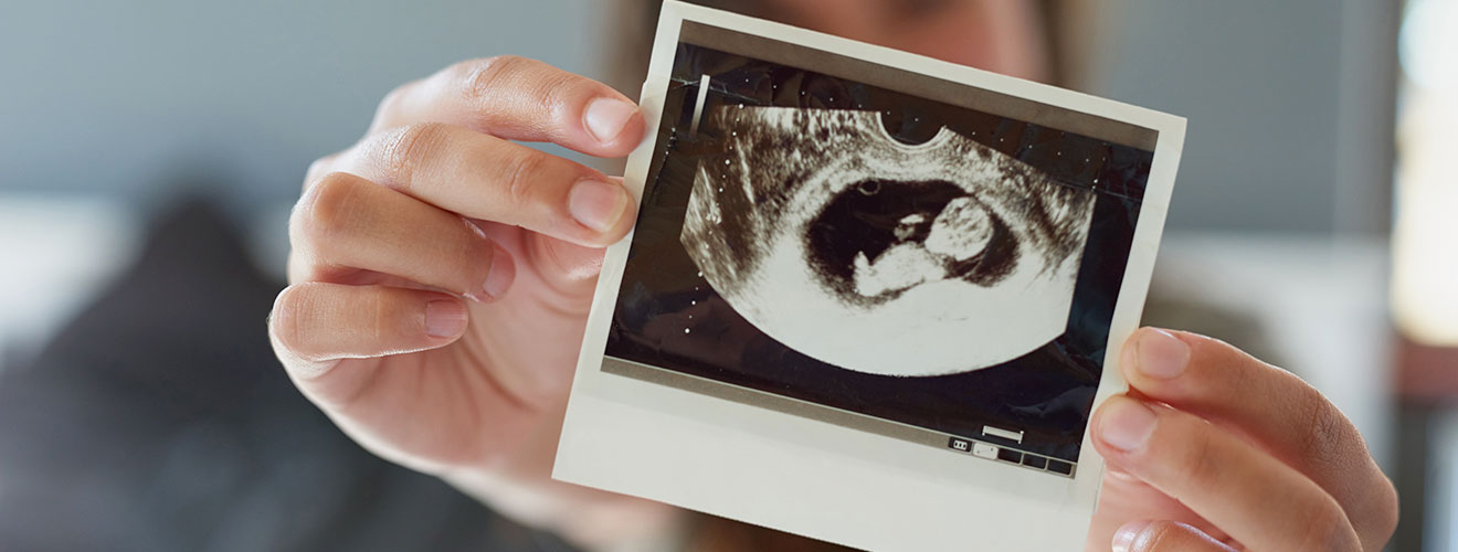 Fetal Echocardiography